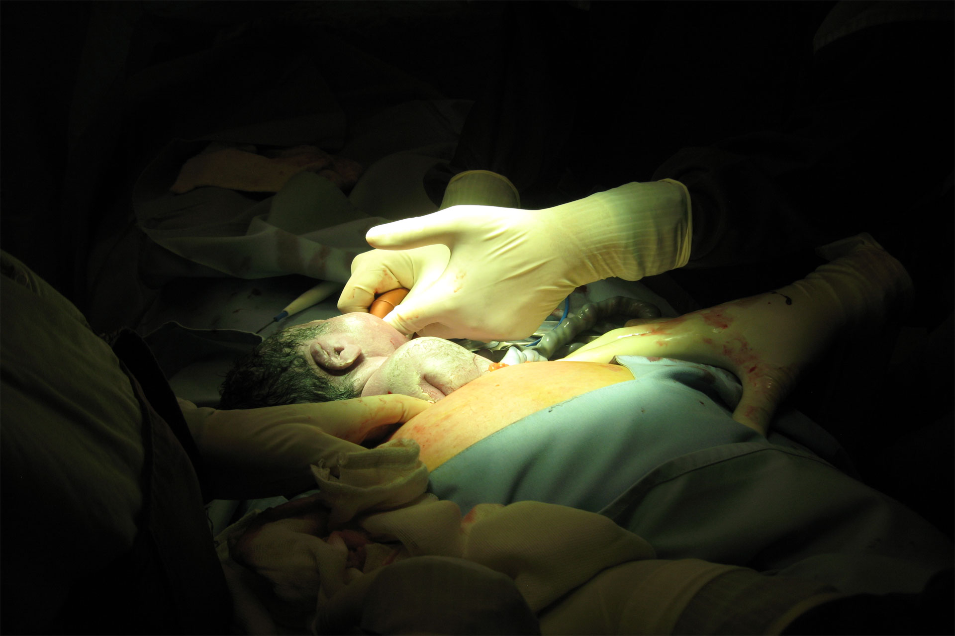 neonatal